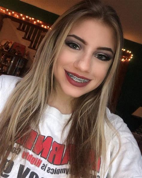 The Best 100 Pornstars with Braces